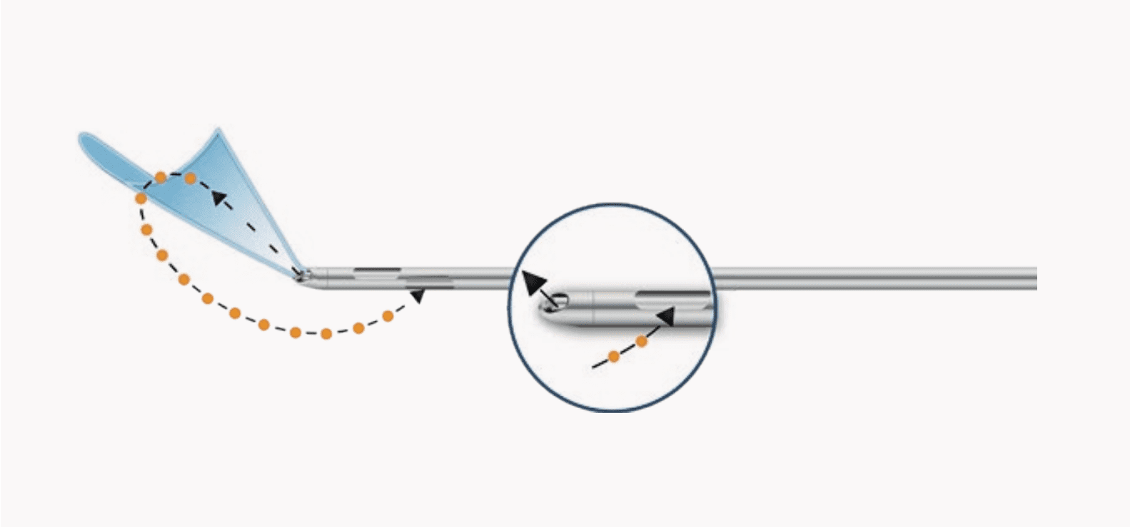 bodyjet® Liposuction and lipotransfer Human Med AG
