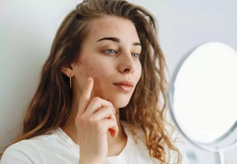 Zinc et Acné Quels sont les effets du zinc sur les boutons