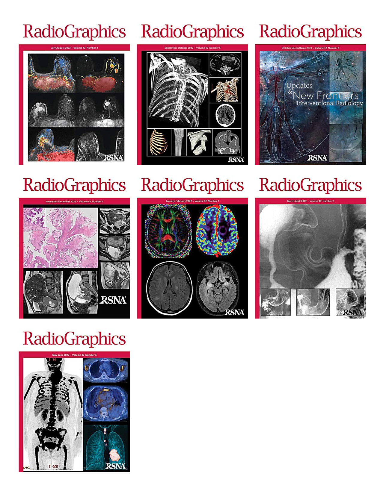 RadioGraphics 2022 Full Archives (True PDF) Afkebooks Medical