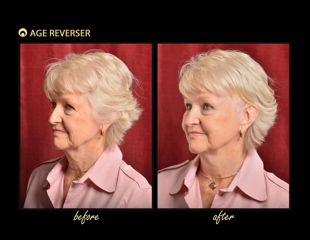 Noninvasive Antiaging INSTANT FACE LIFT band by Age Reverser