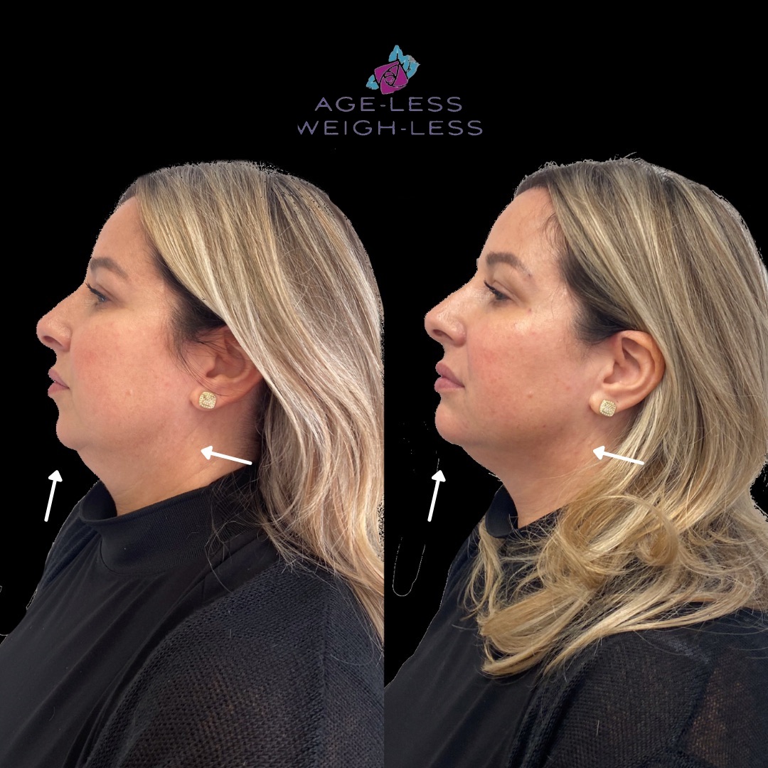 Med Spa Near Me Woburn & Dover Weight Loss Clinic