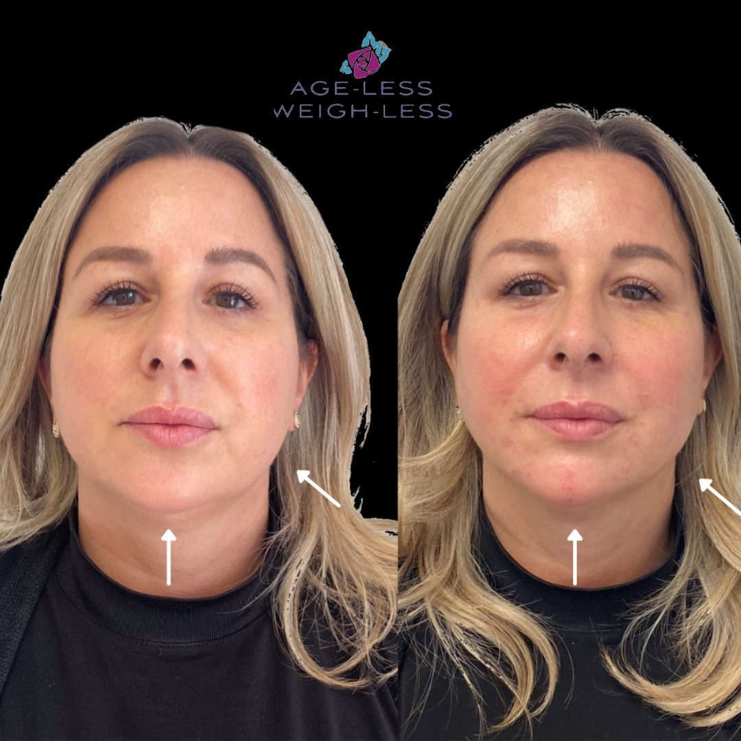 Med Spa Near Me Woburn & Dover Weight Loss Clinic