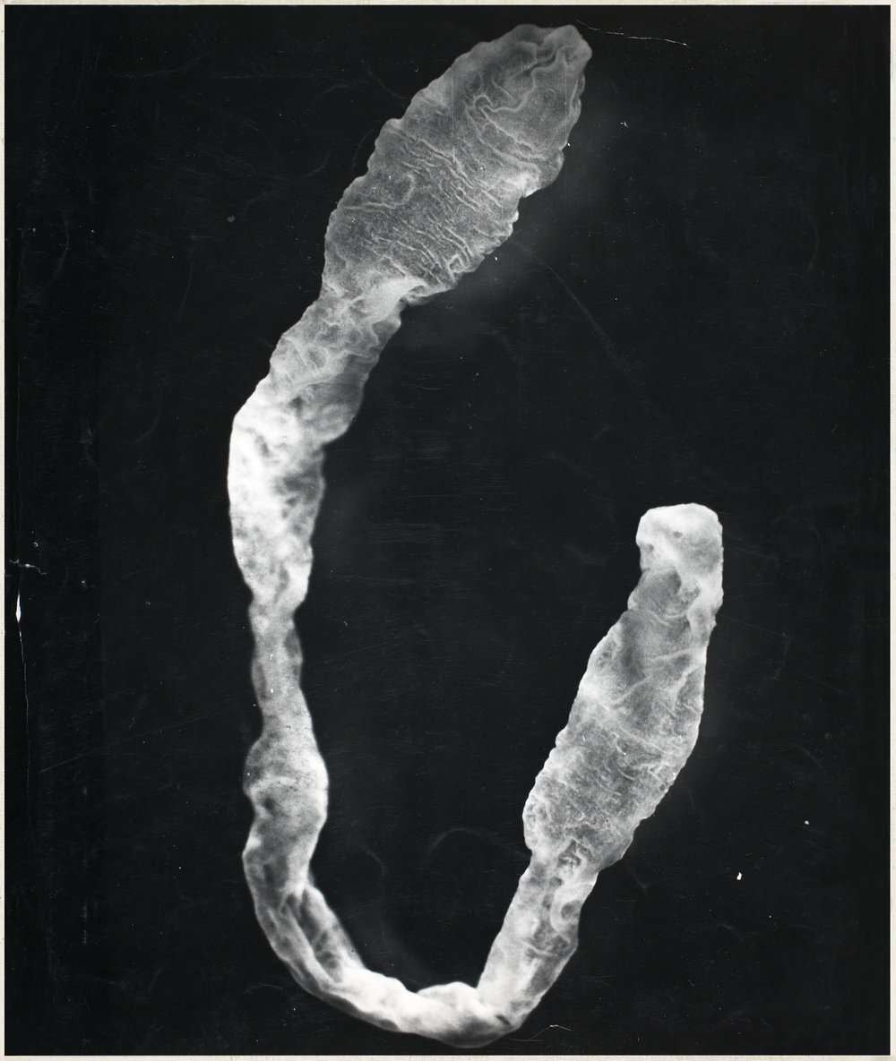 Spirometra tapeworm larva AgResearch