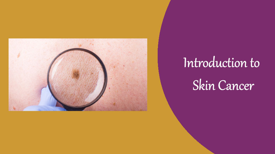 Skin Cancer A Comprehensive Guide to Types and Symptoms