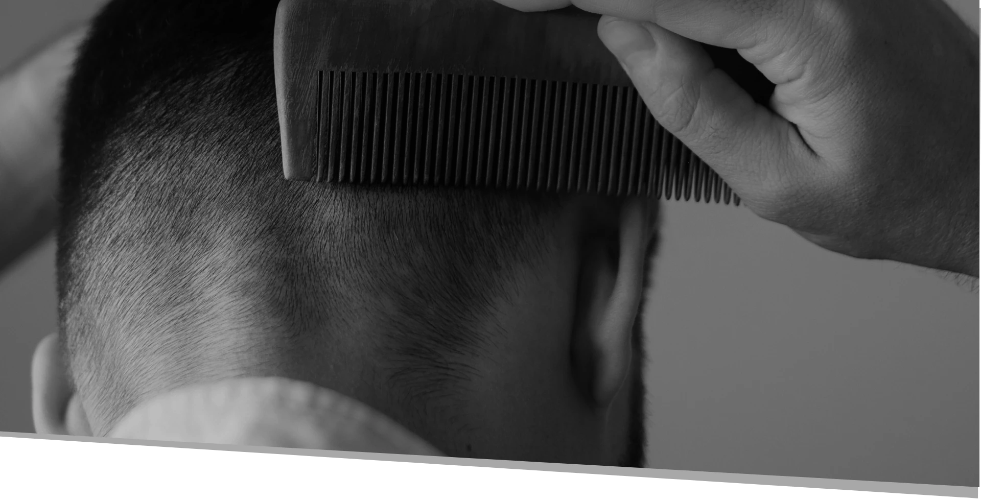 Hair Restoration in San Diego