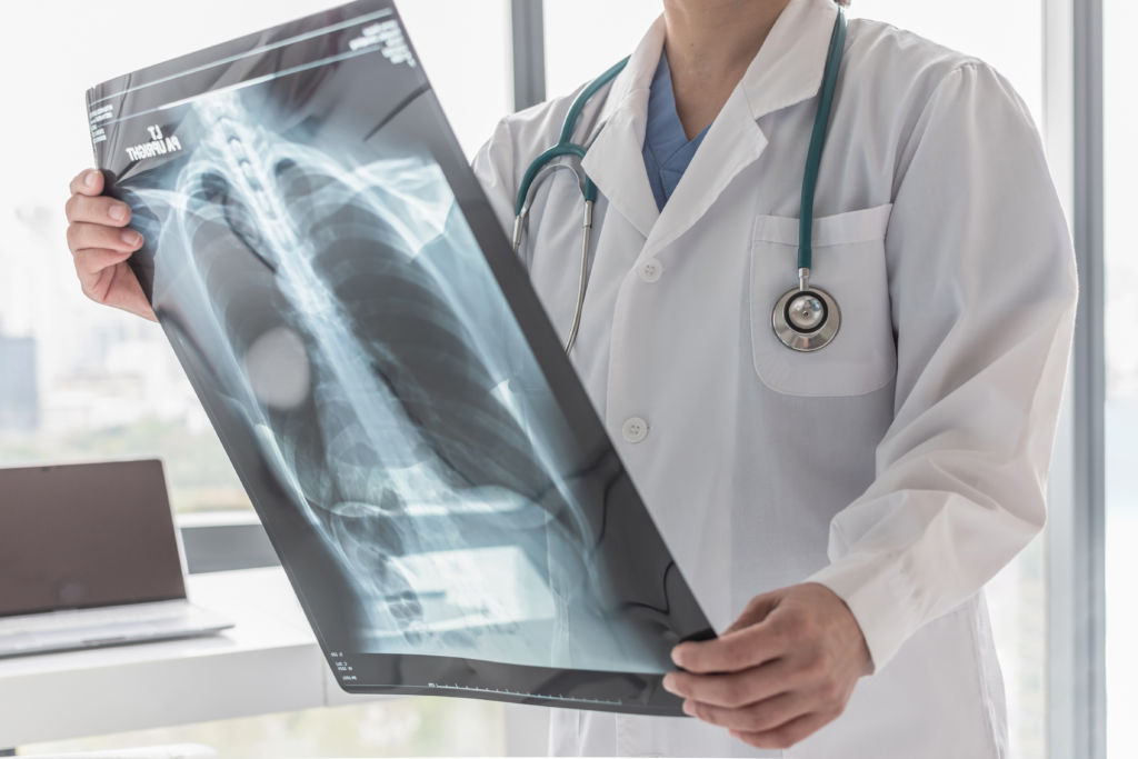 Do you need an xray? health enews
