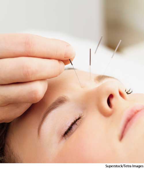 American Heritage Dictionary Entry acupuncture