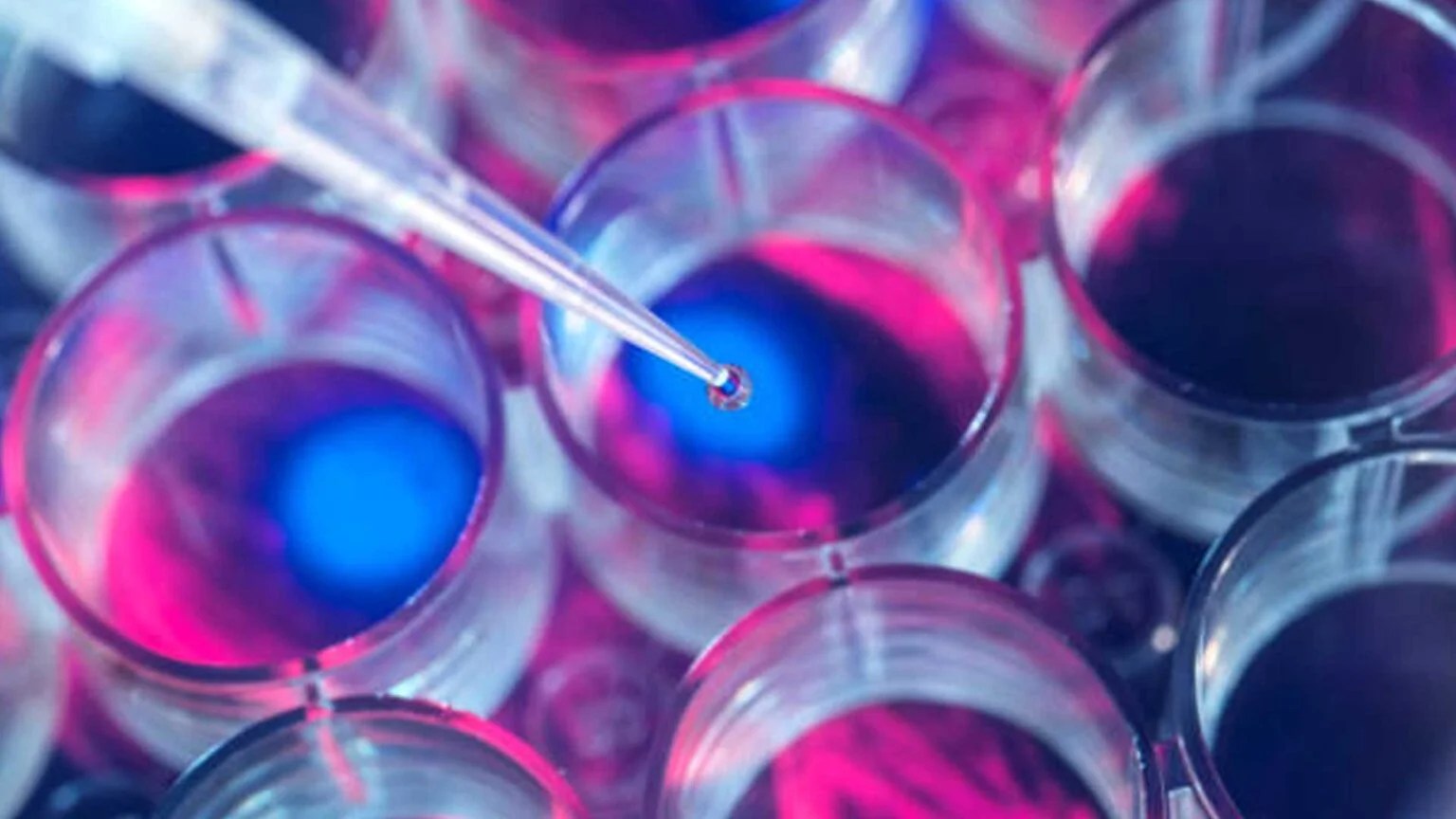 Personal Genome Diagnostics Maggie RougierChapman AITech Park