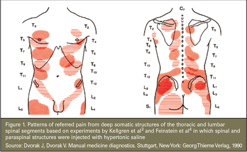 Figure 1 from Back, chest and abdominal pain is it