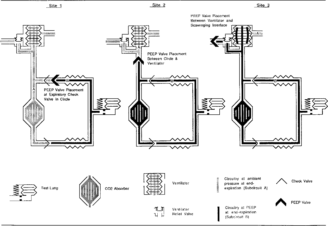 Positive End Expiratory Pressure Implications For Tidal Volume