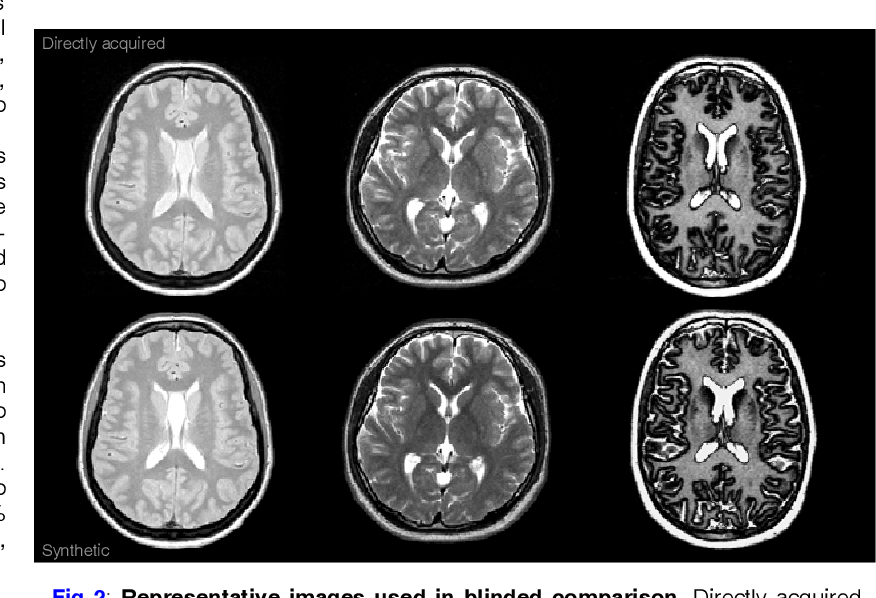 Figure 2 from Synthetic vs. directlyacquired MRI of identicalslice