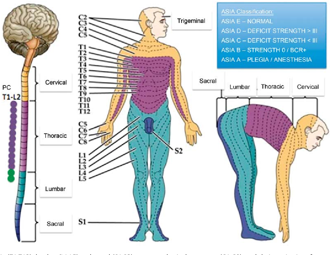 Figure 1 from Neurogenic Shock Clinical Management and Particularities