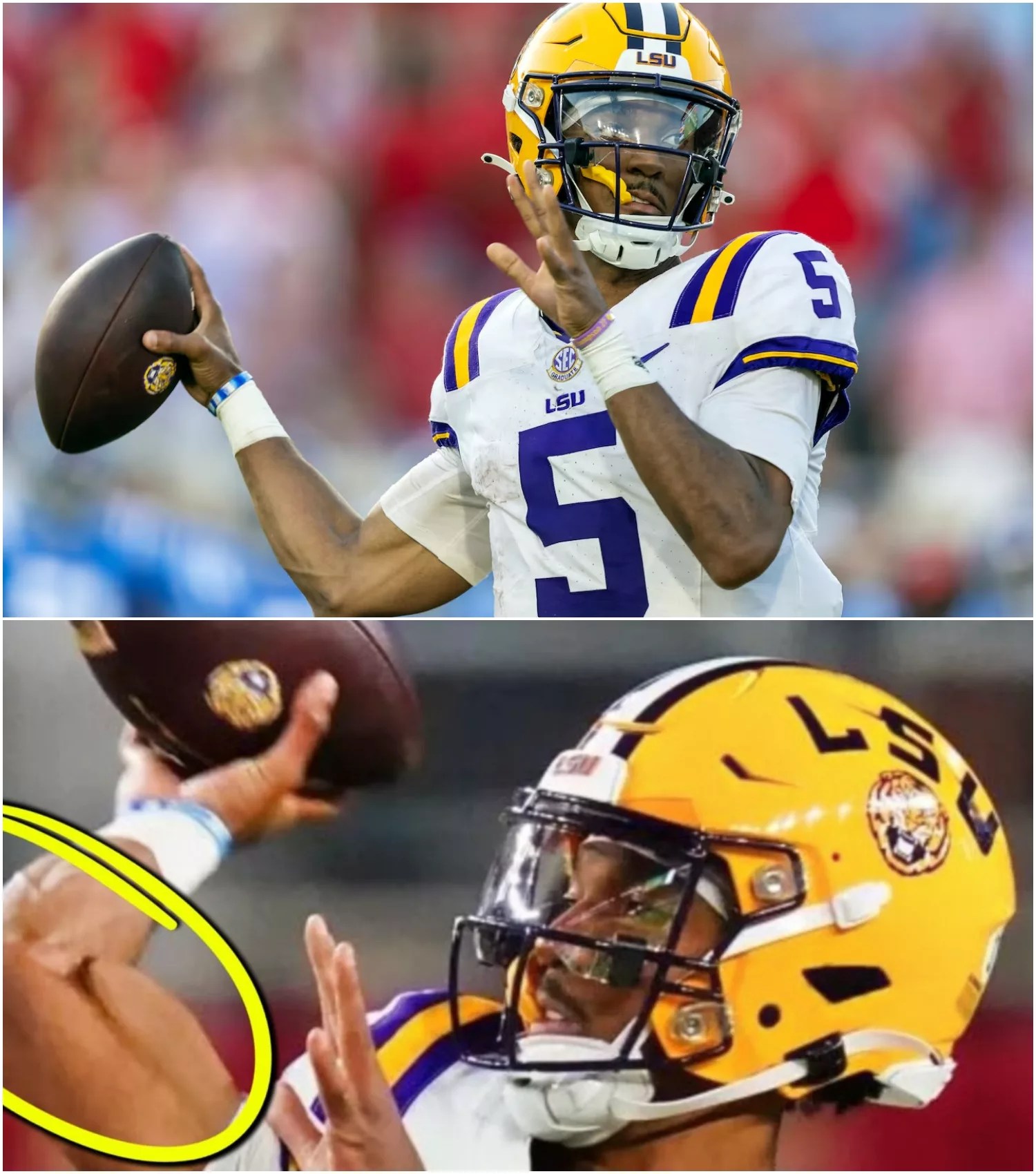 Gruesome Photo Resurfaces Of Jayden Daniels Elbow Popping At Lsu Why
