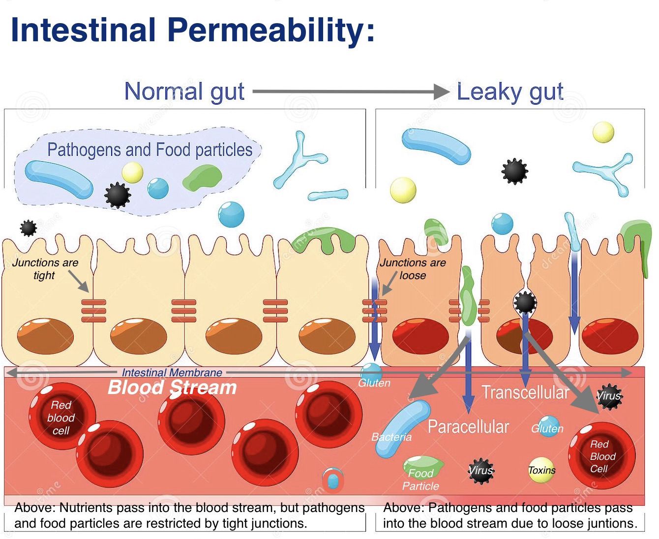 AIMA Functional Medicine Intestinal Permeability