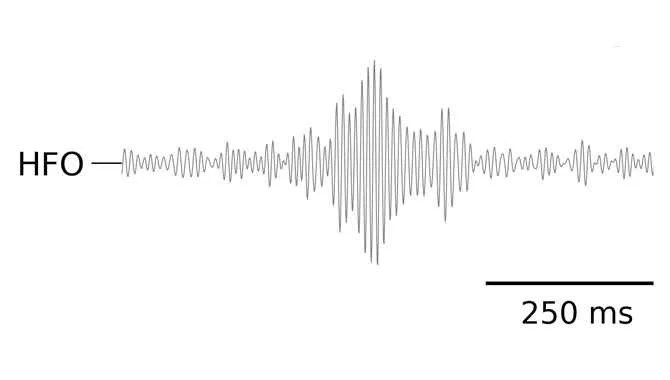 High Frequency