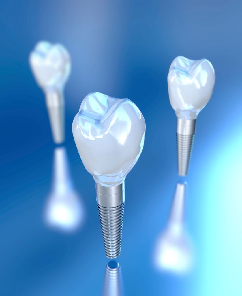 Types of Dental Prostheses Available in Malaysia