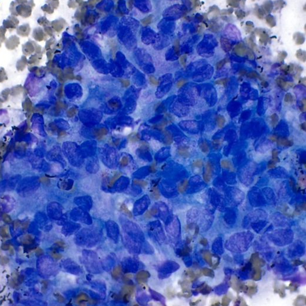 Cytology AirClean Systems