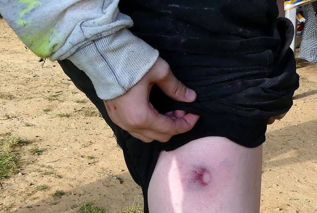 How Much Does Airsoft Hurt? How to Reduce The Pain