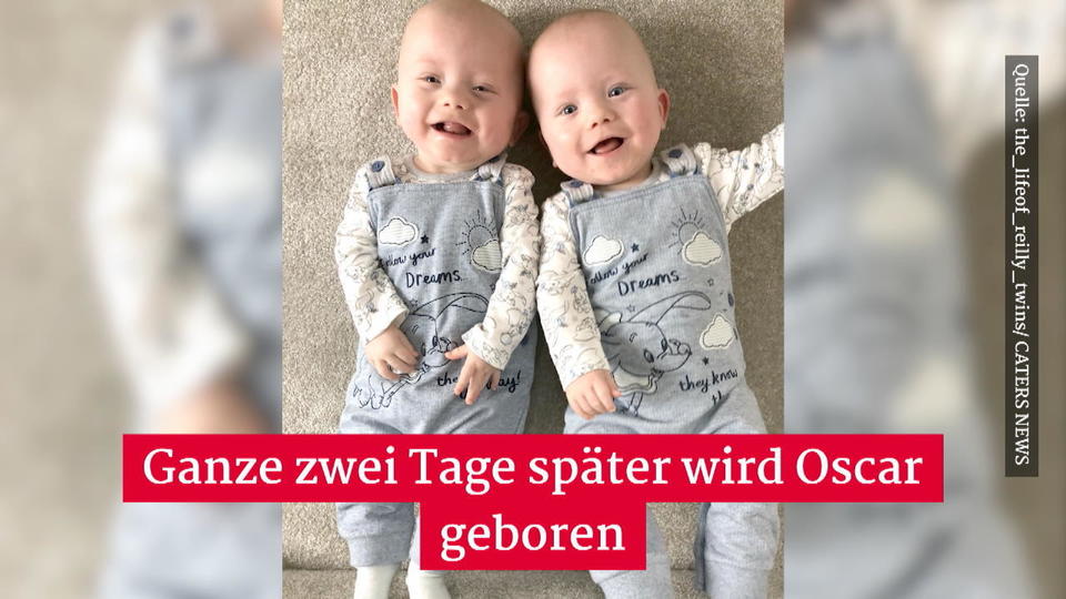 Besondere Zwillinge Baby Oscar kommt erst 2 Tage nach Zwillingsbruder