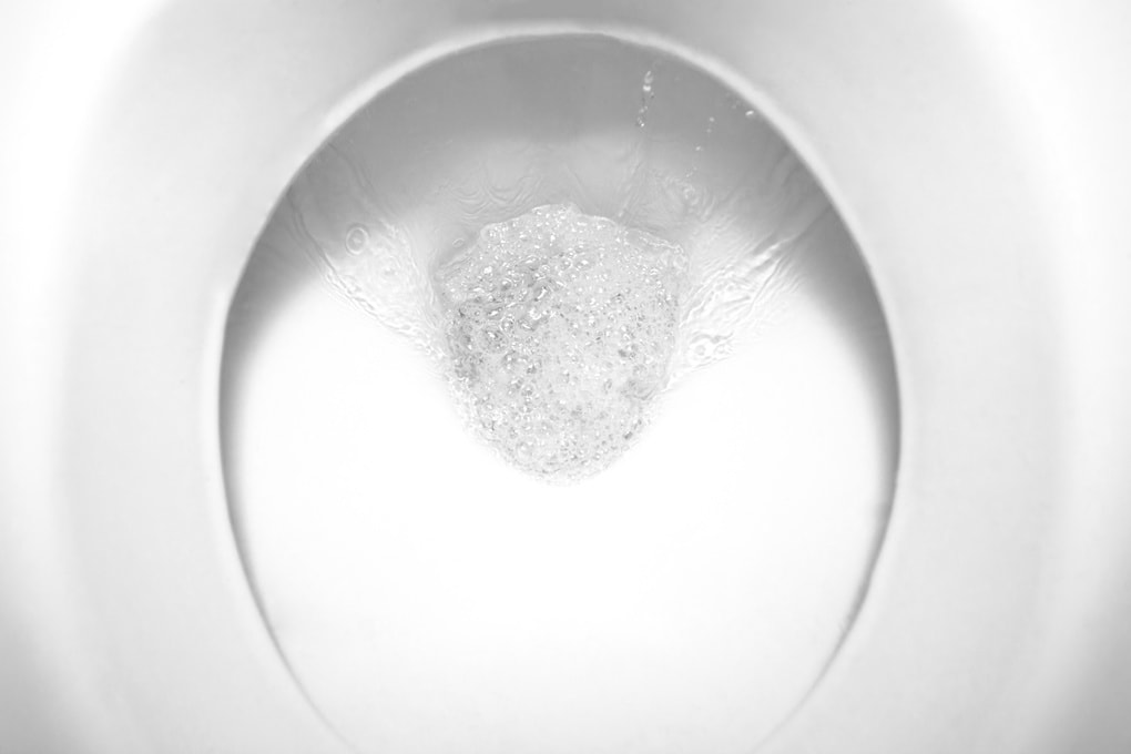 5 Reasons Your Toilet Wont Stop Running Causes & How To Fix