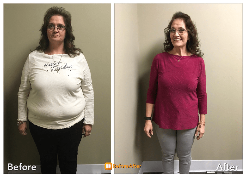 Best Way to Lose Weight Semaglutide Weight Loss Program