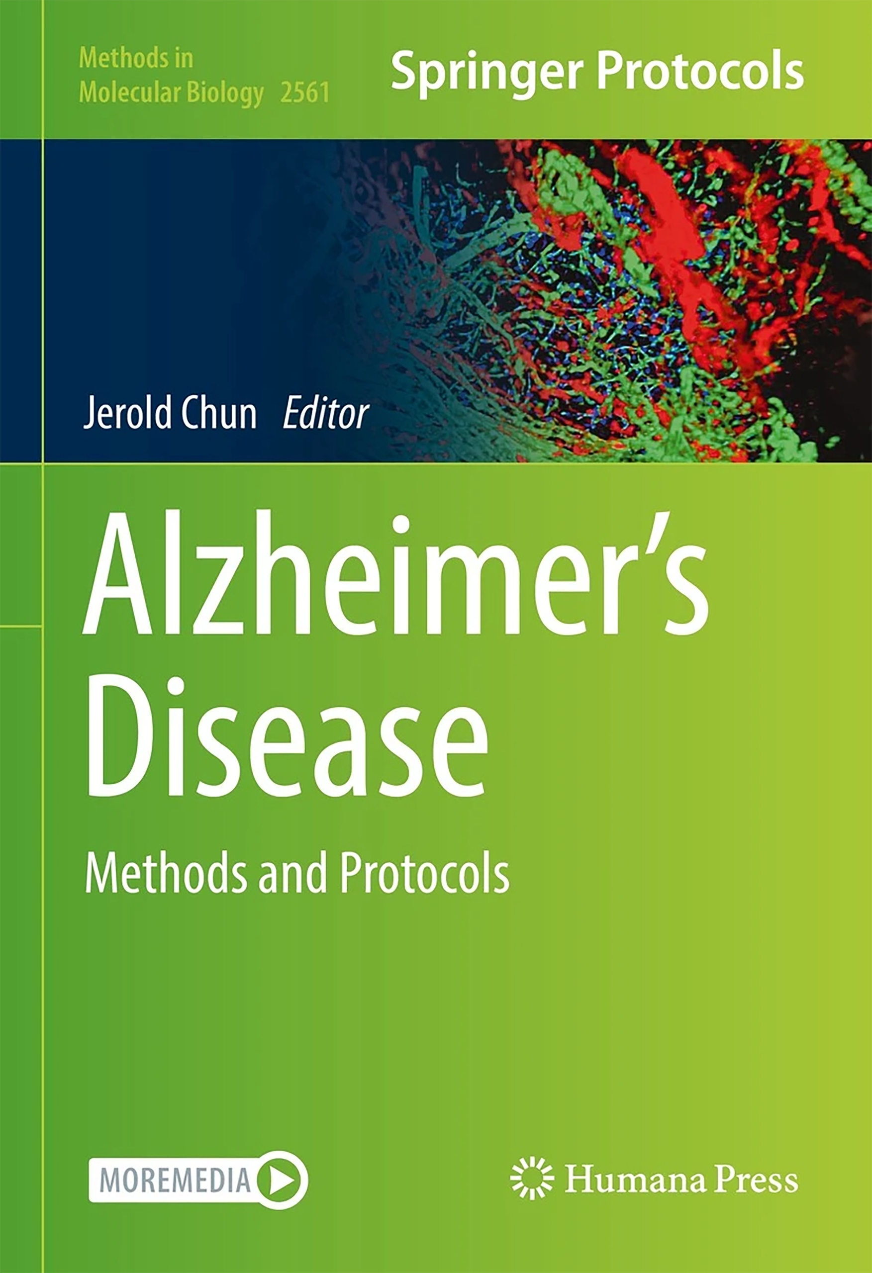 Our Chapter Was Selected For The Alzheimer’s Disease Book Cover