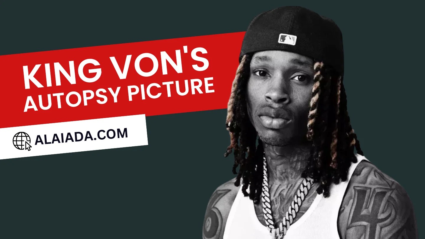 Truth Behind King Von's Autopsy Picture Fact vs. Fiction(02)