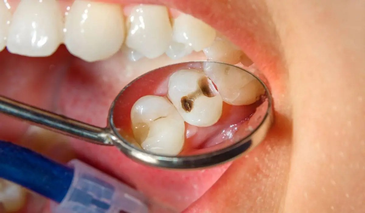 تخصصات طب الأسنان ومدتها