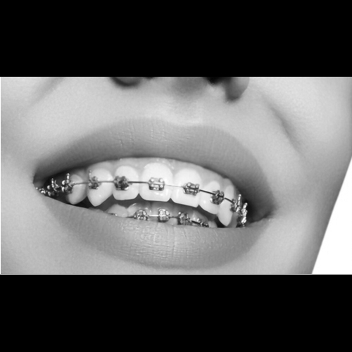 Orthodontics Braces and Clear Aligners Al Bahri Dental and