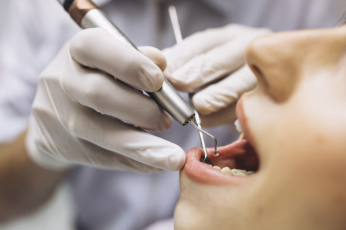 Obturación dental • Alba & Hernanz