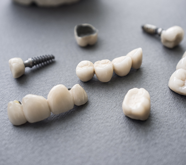 Difference Between Dental Implants & Mini Dental Implants Family