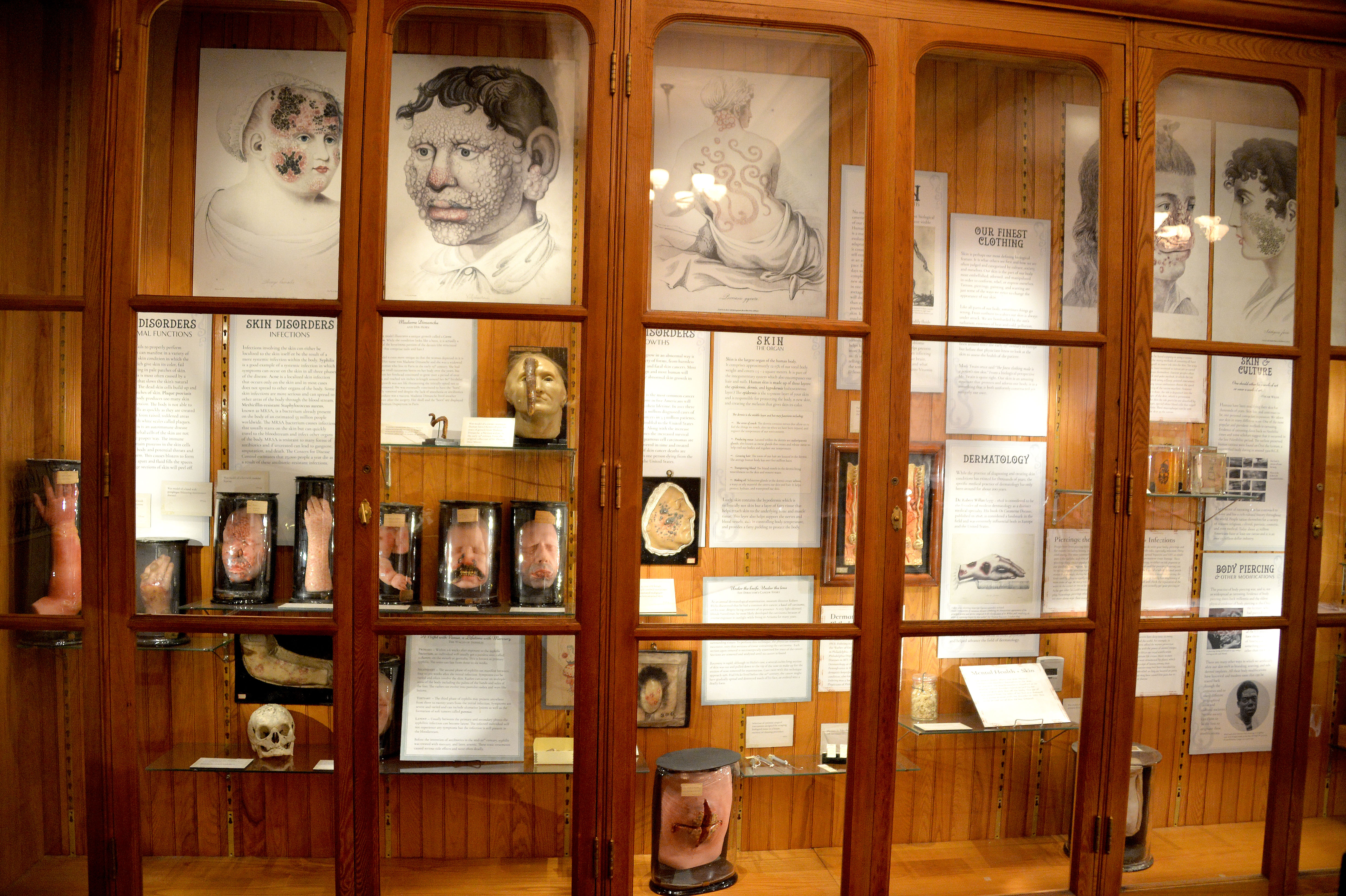 Mutter Museum's Medical Mysteries AL DÍA News