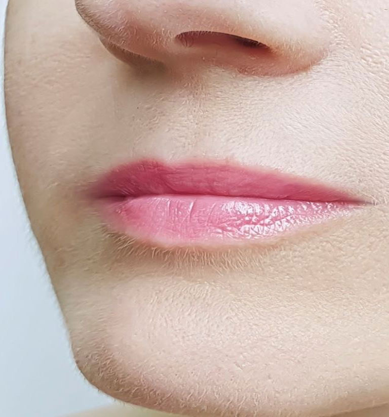 Cosmetic Injections Tulsa, OK Align Injectable Aesthetics