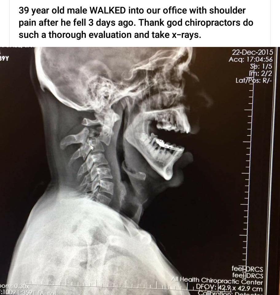 Chiropractors Why do you take Xrays? Alignable