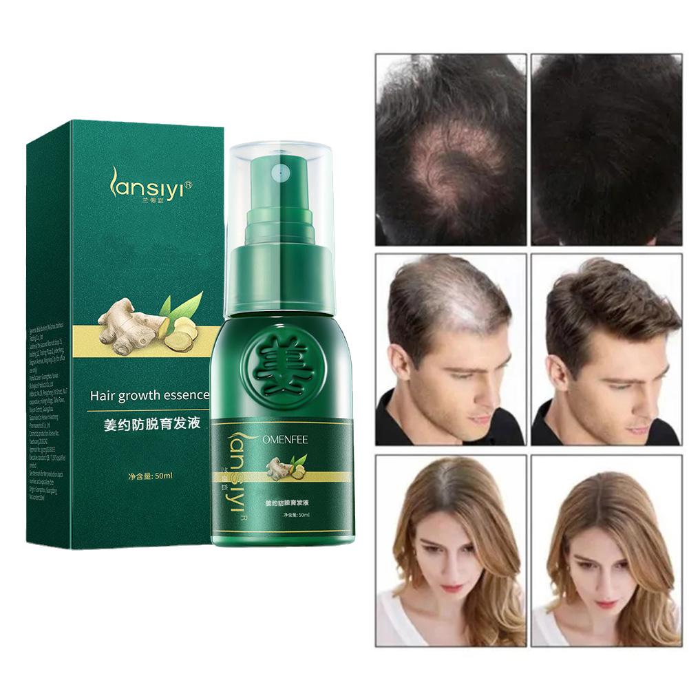 Ginger Hair Growth Spray Dropshipping Winning Products
