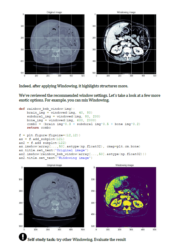 Course Medical Image Analysis In Python Alimbekov Renat