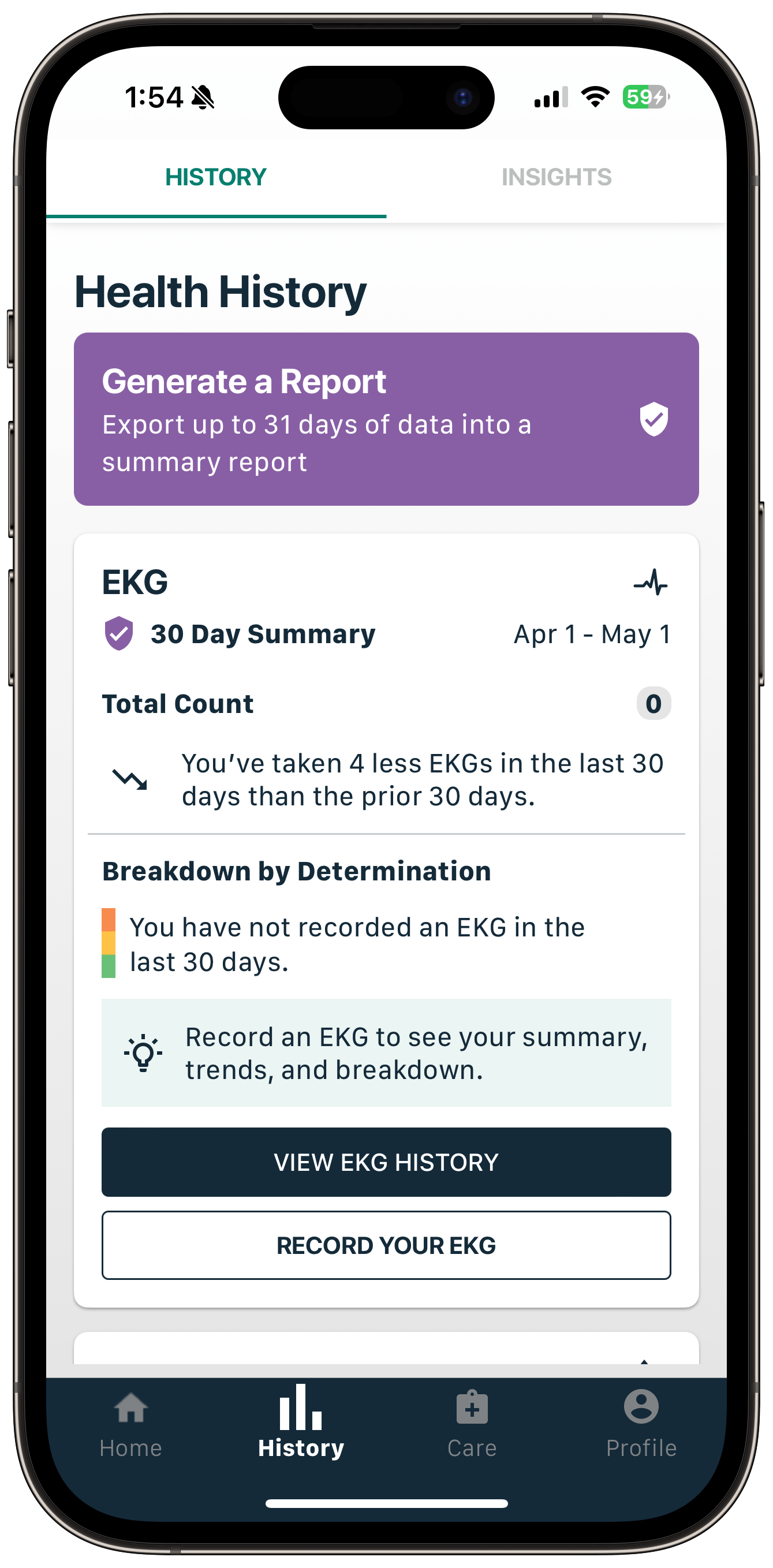 How do I download my EKG PDF from the Kardia app to share with my