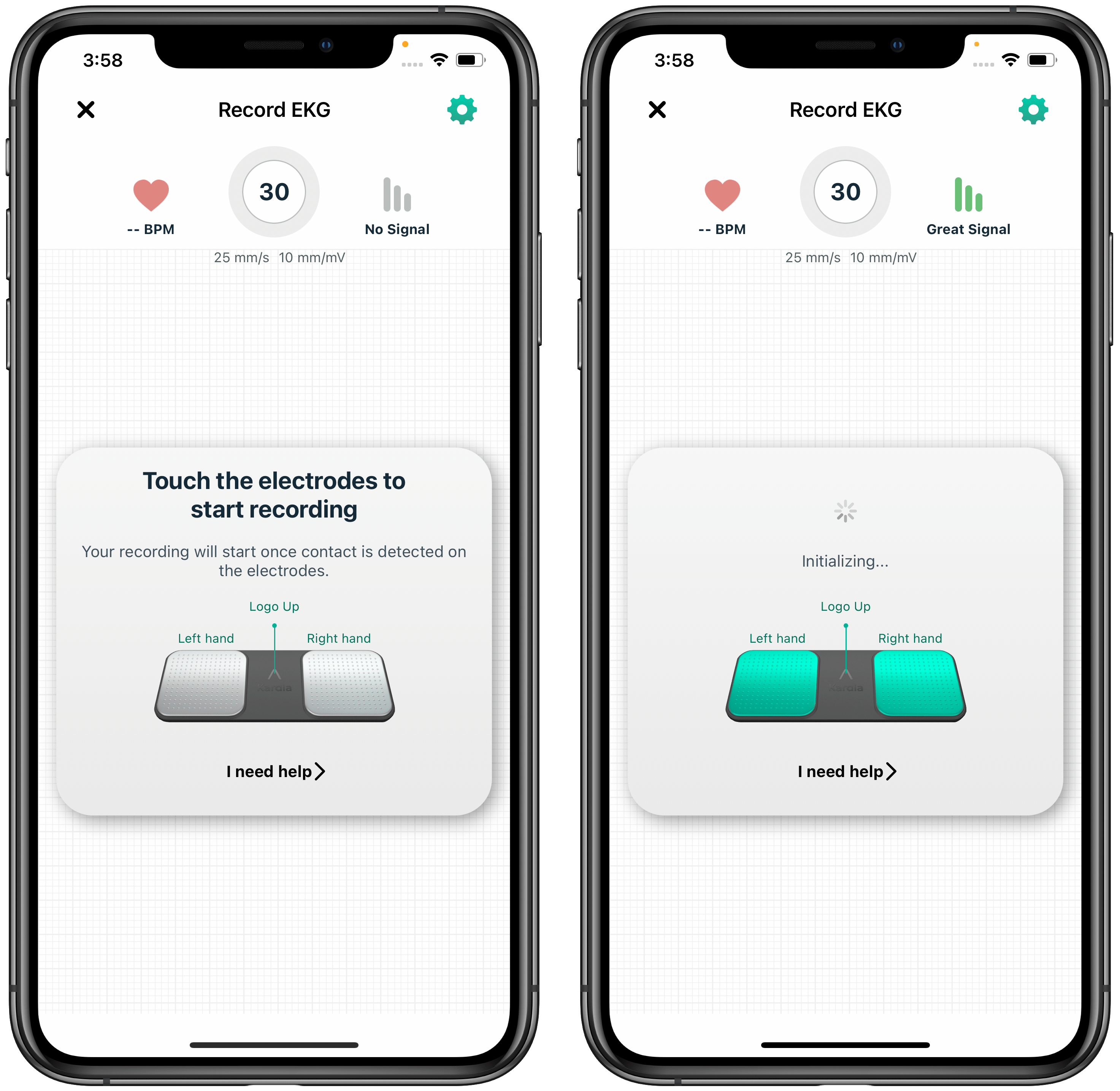 Setting up your KardiaMobile AliveCor Support