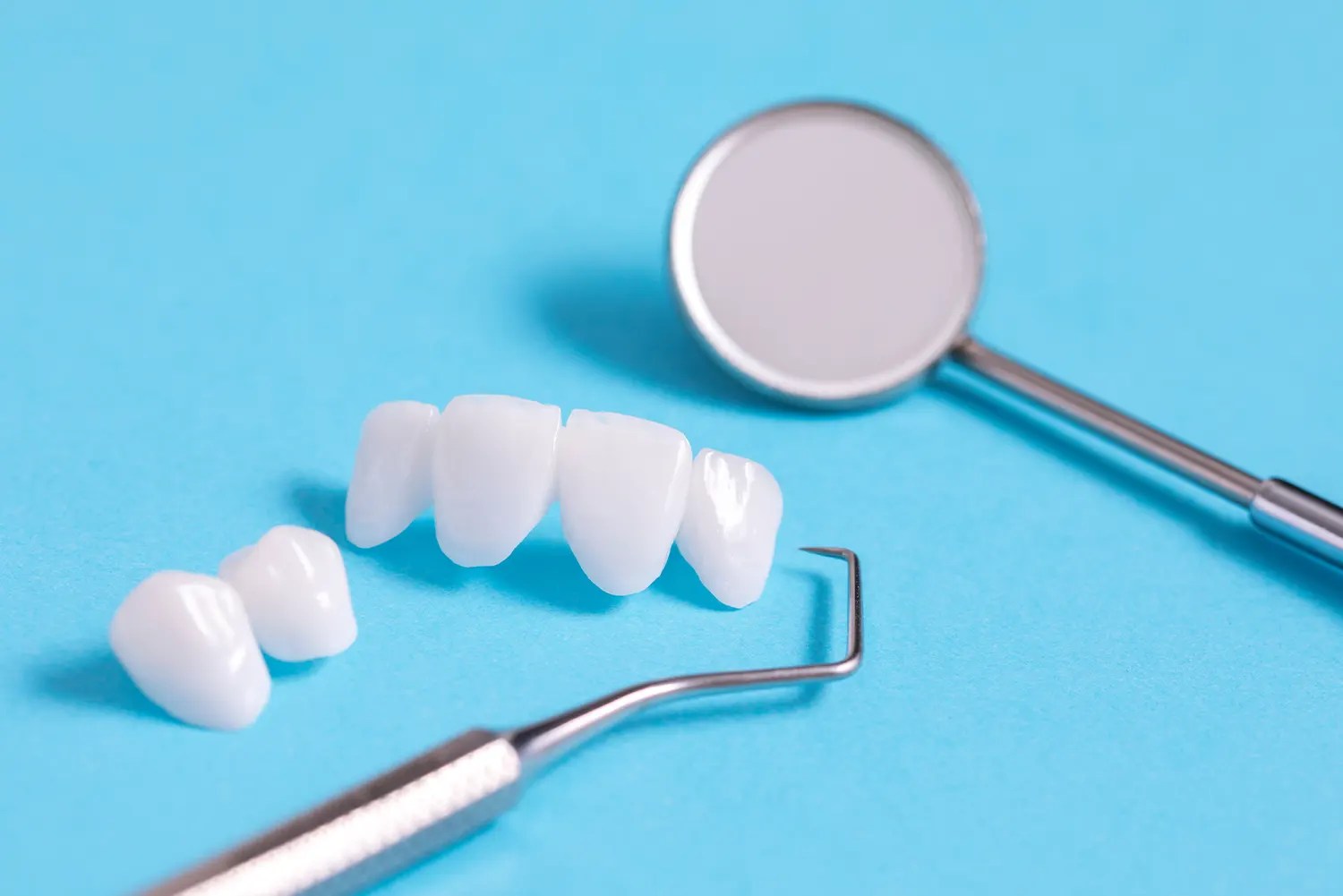 What Do Teeth Look Like Under Veneers? All About Smiles Family Dentistry