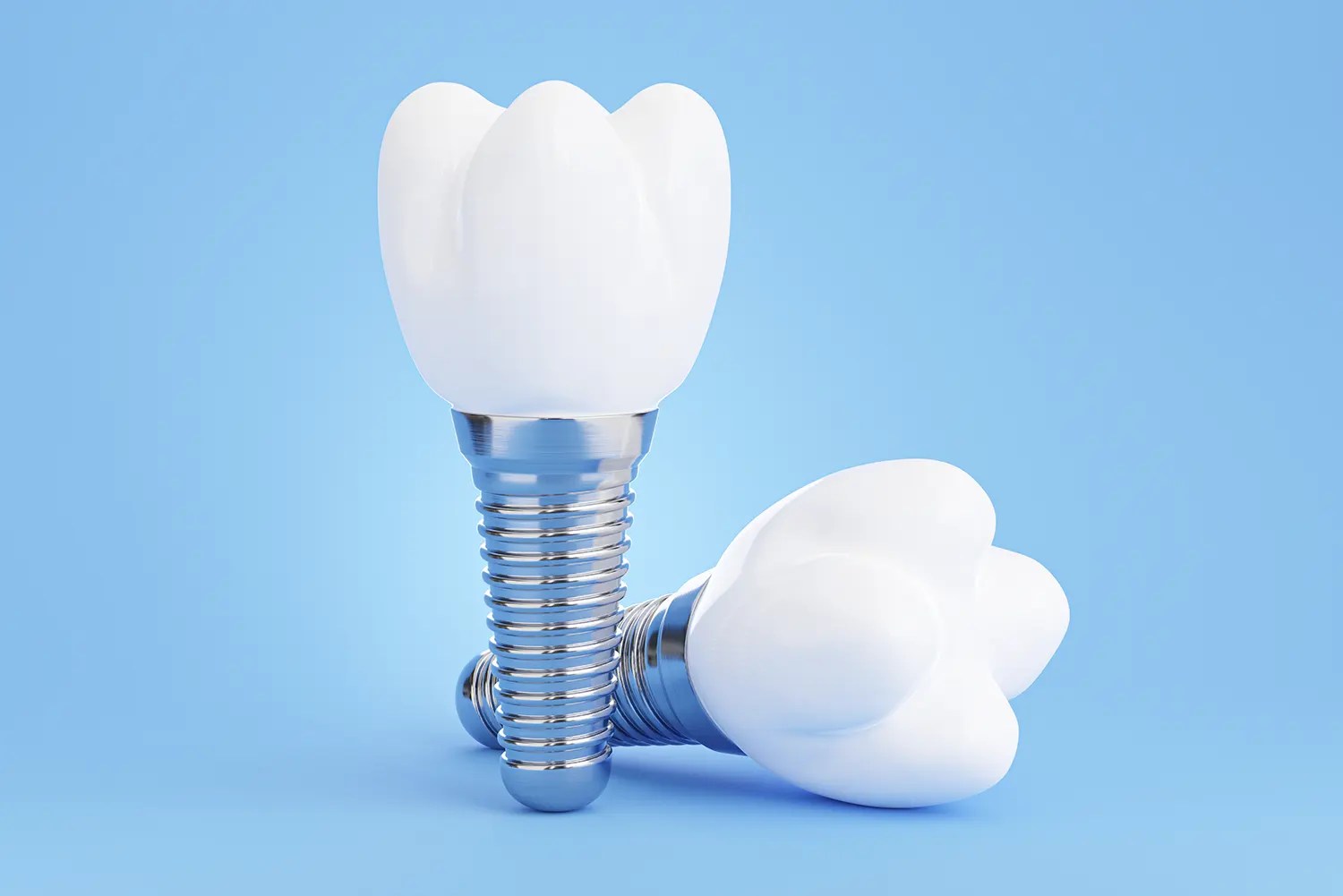How Long Does a Dental Implant Last?