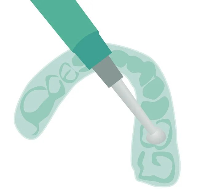 SW Edmonton Dentist Teeth Whitening Instructions Allard Station Dental