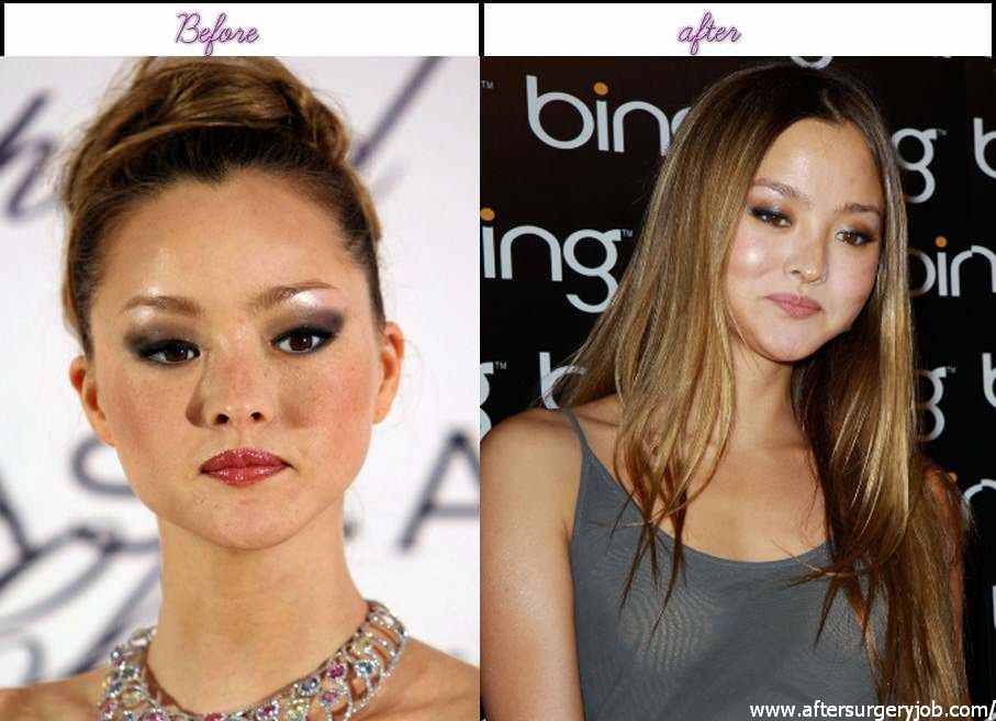 Devon Aoki All Celeb Surgery 5