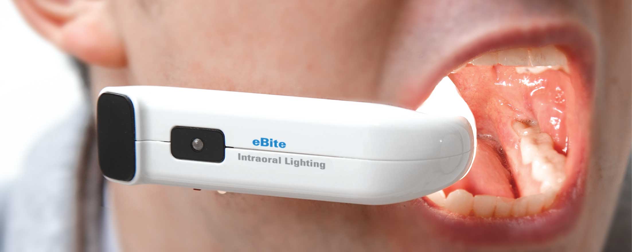 eBite Portable intraoral light source Alldent