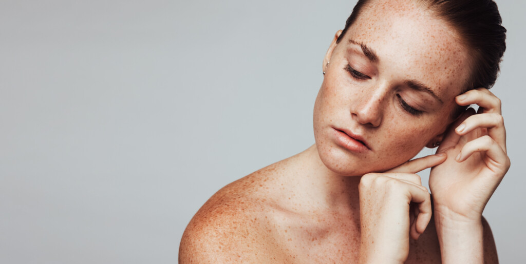 Facial Hyperpigmentation Causes, Prevention & Treatments