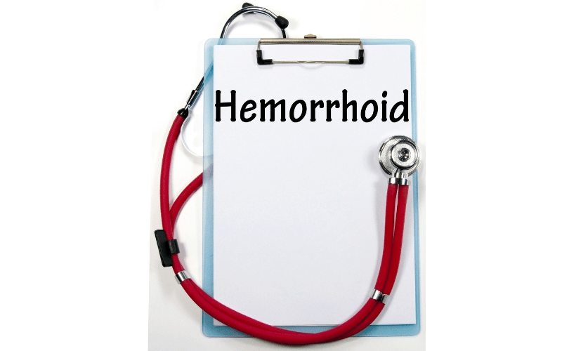 Itchy Hemorrhoids A Guide for Treatment & Prevention