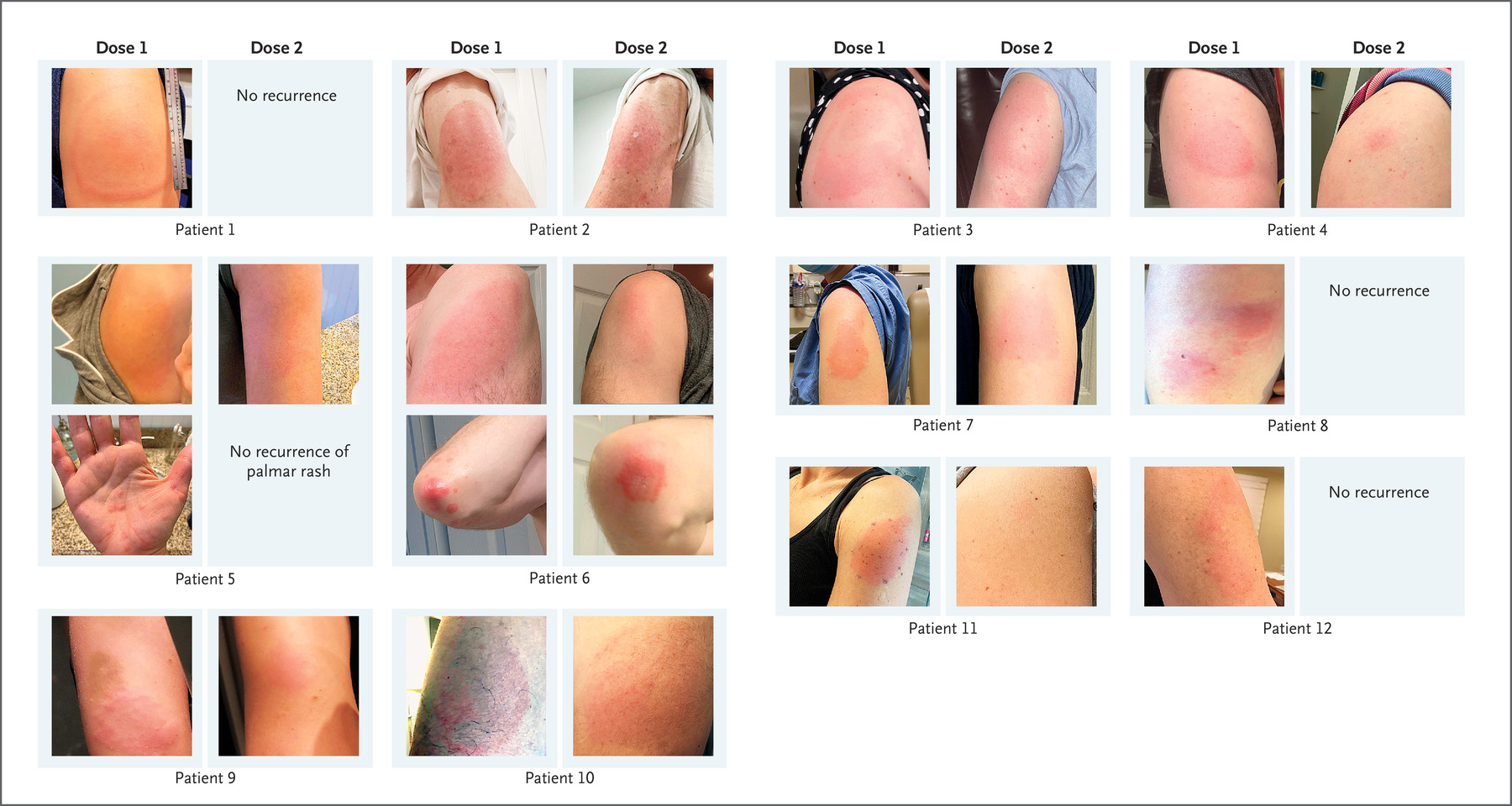 Publications Mass General Allergy Research