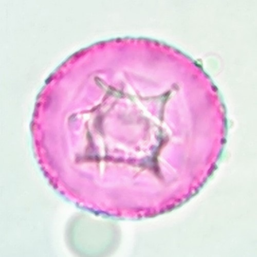 Juniper pollen allergy (Juniperus) a quick guide w/ photos. » Allerma™