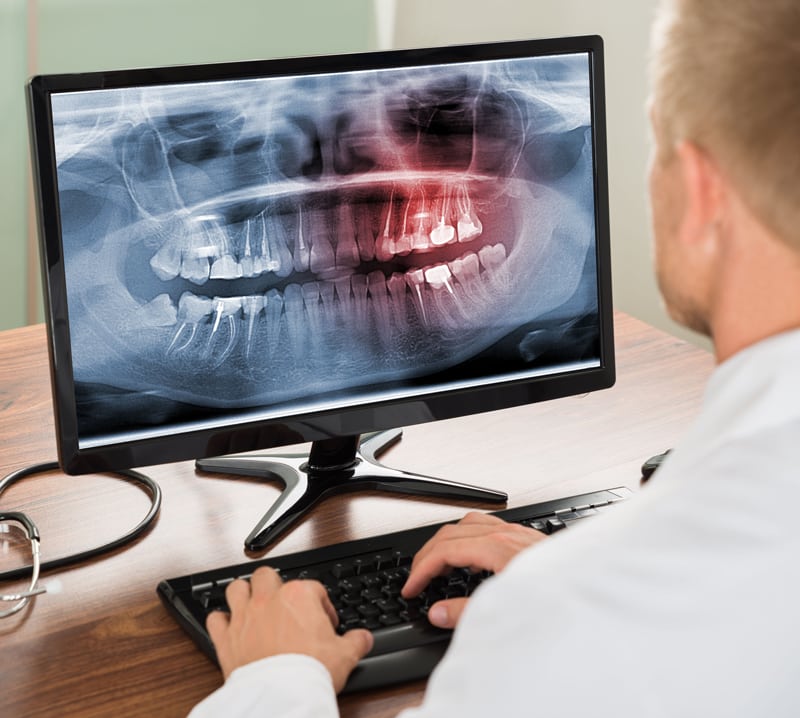 Dental Digital XRays Alliance Dental Specialists Oakville