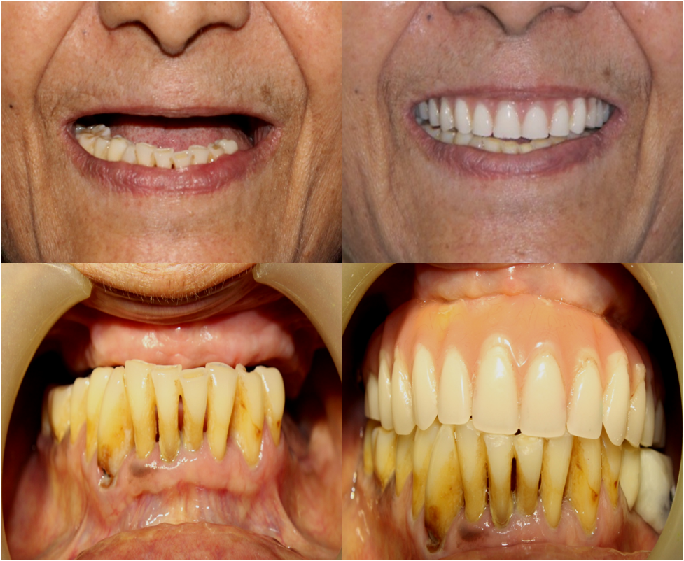 Before/ after treatment photos