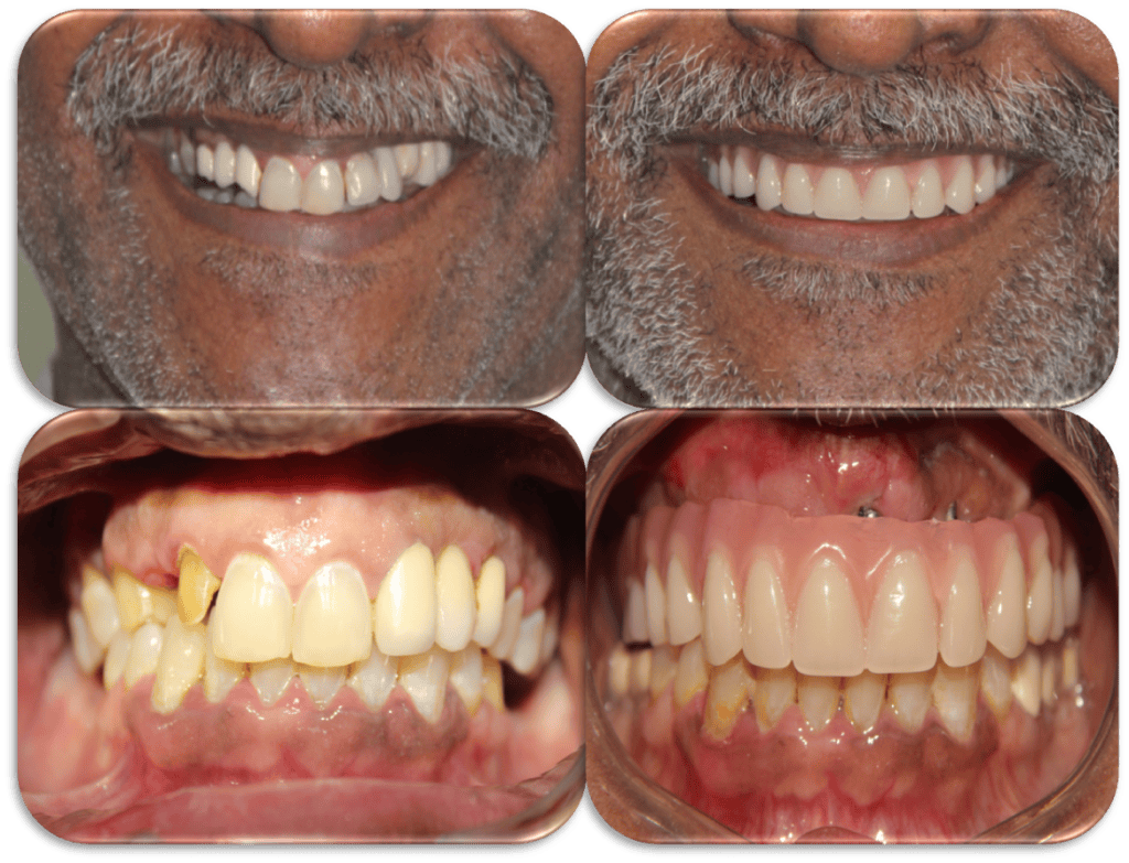 Before/ after treatment photos